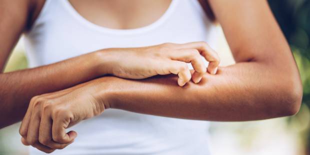 Young women hand scratch the itch on the arm, healthcare and medicine concept.
